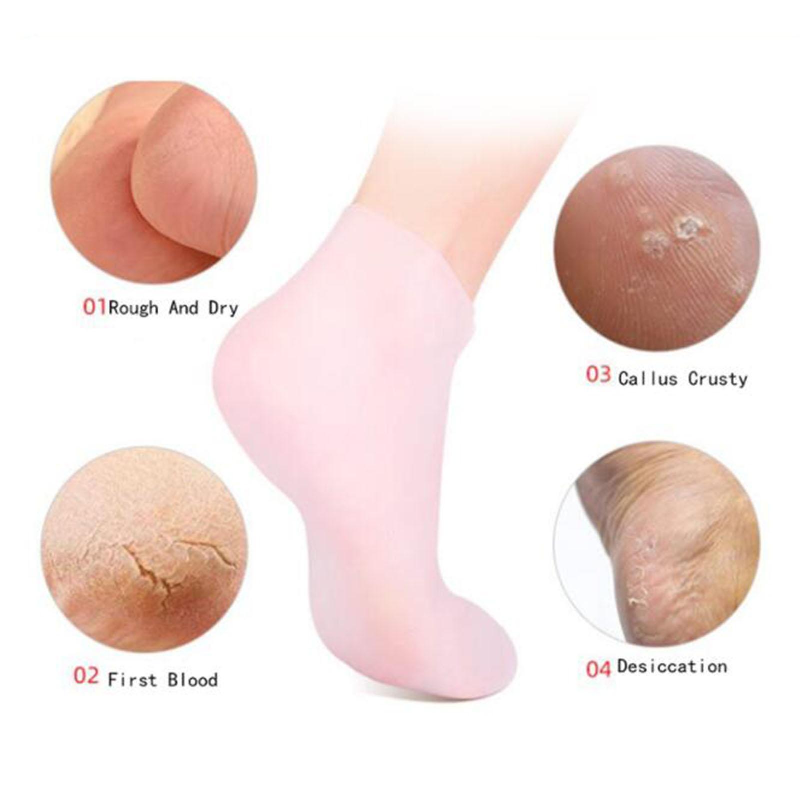 부드러운 실리콘 젤 양말 발가락 양말 보호 발 관리 보 - Xl Skincare 리뷰 및 가격